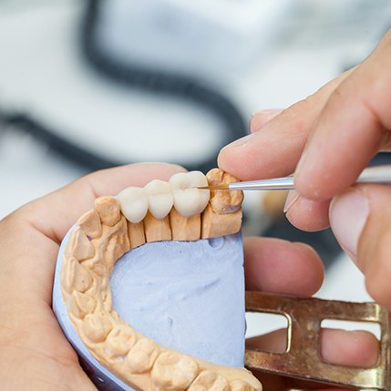 Dental lab technician working on dental bridge