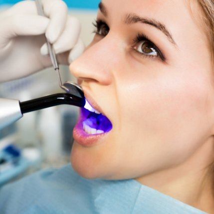 Woman getting direct bonding from cosmetic dentist