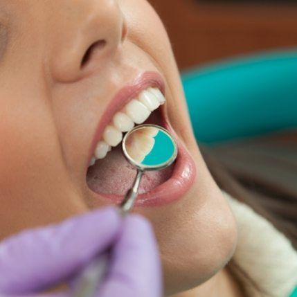 Close up of mouth with dental mirror