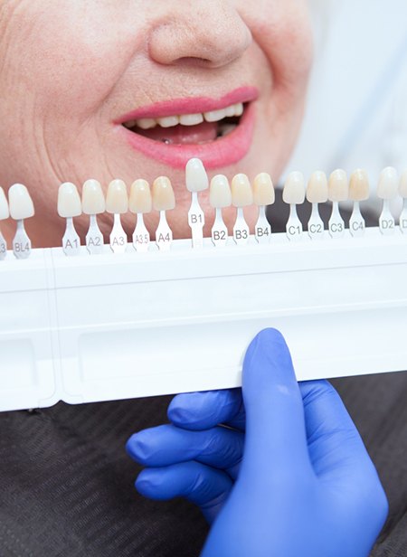 Patient getting shade-matched for dental crown