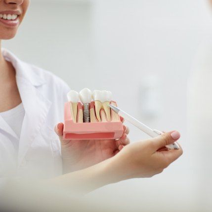 Dentist showing a patient a dental implant model