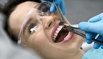 factors that can affect the cost of tooth extraction include the location of the tooth