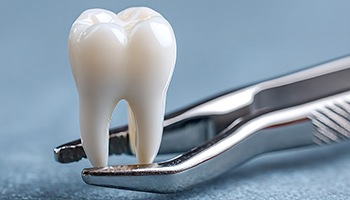 Flexible financing may help make your tooth extraction more affordable