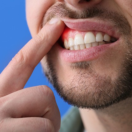 Catonsville patient smiling after gum disease treatment