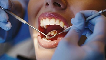 Dentist examining a patient’s mouth with a dental mirror