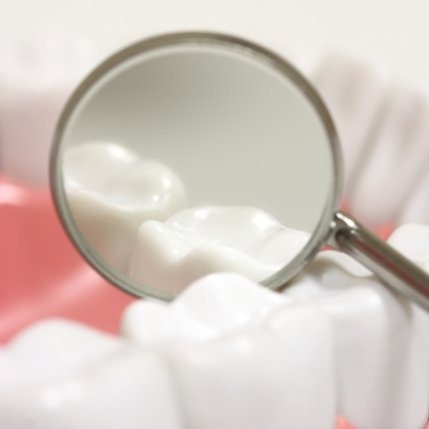 Animated dental mirror looking at teeth with dental sealants